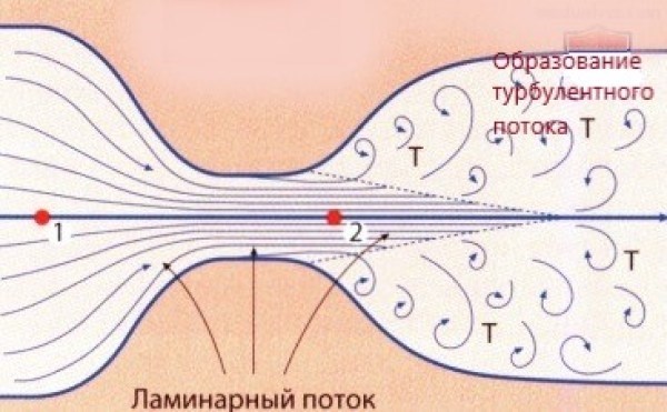 Способы устранения гула на вводе горячей воды в доме